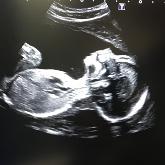 Babylist Registry Photo.