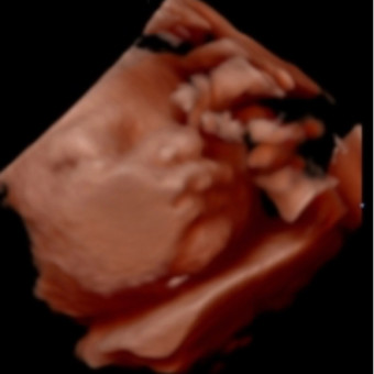 Babylist Registry Photo.