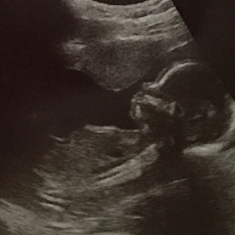 Babylist Registry Photo.