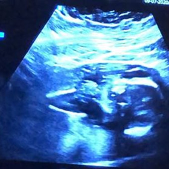 Babylist Registry Photo.