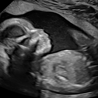 Babylist Registry Photo.