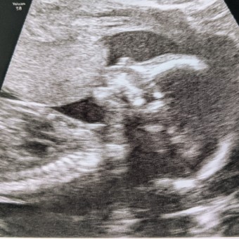 Babylist Registry Photo.