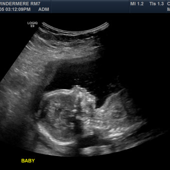 Babylist Registry Photo.