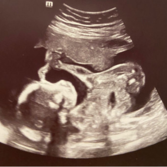 Babylist Registry Photo.