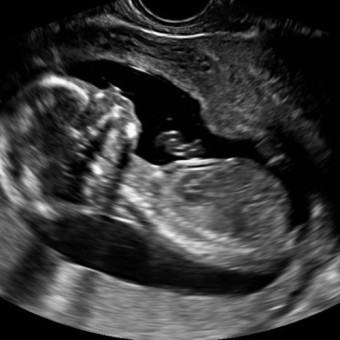 Babylist Registry Photo.