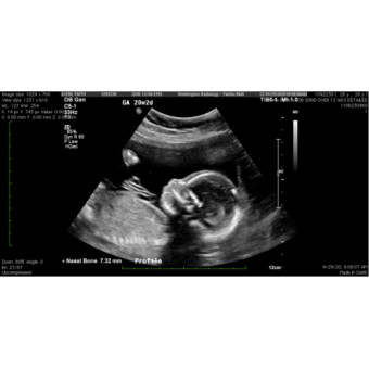 Babylist Registry Photo.