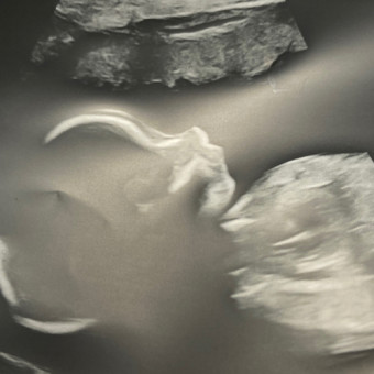 Babylist Registry Photo.