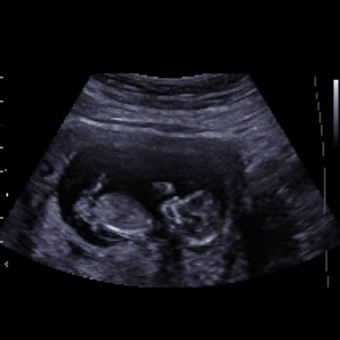 Babylist Registry Photo.