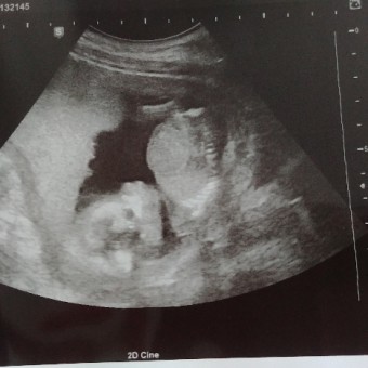 Babylist Registry Photo.