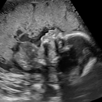 Babylist Registry Photo.