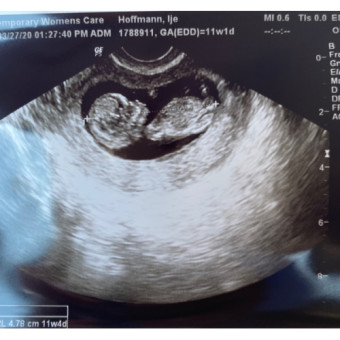 Babylist Registry Photo.