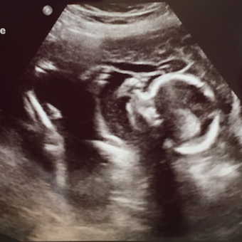 Babylist Registry Photo.