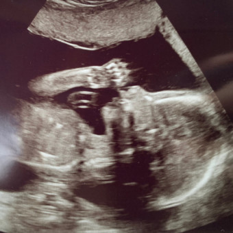 Babylist Registry Photo.