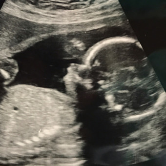 Babylist Registry Photo.