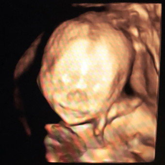 Babylist Registry Photo.