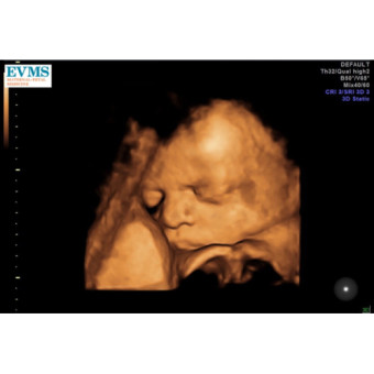 Babylist Registry Photo.