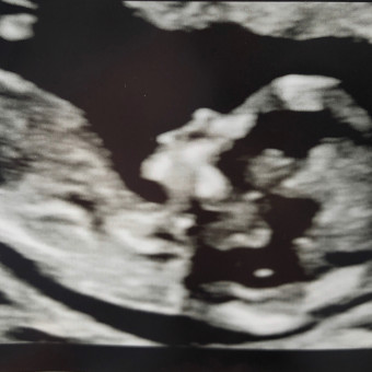 Babylist Registry Photo.