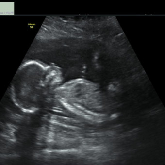 Babylist Registry Photo.