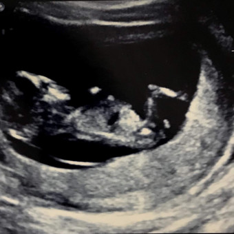 Babylist Registry Photo.