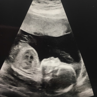 Babylist Registry Photo.