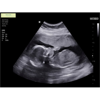 Babylist Registry Photo.