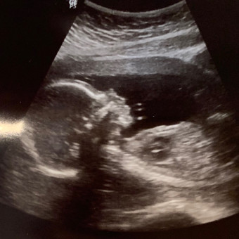 Babylist Registry Photo.