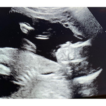 Babylist Registry Photo.