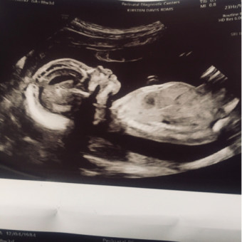 Babylist Registry Photo.