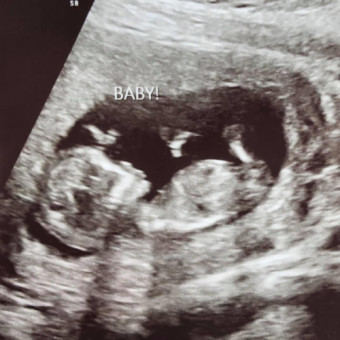Babylist Registry Photo.