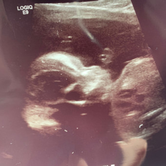 Babylist Registry Photo.