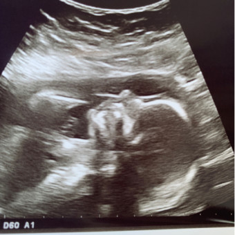 Babylist Registry Photo.