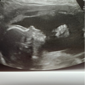 Babylist Registry Photo.