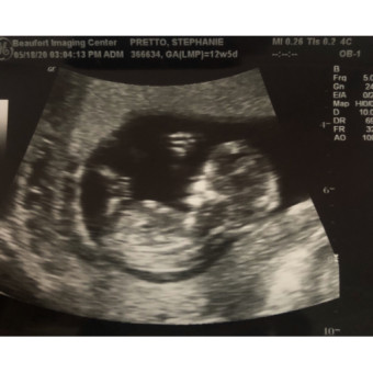 Babylist Registry Photo.
