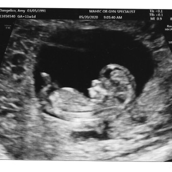Babylist Registry Photo.