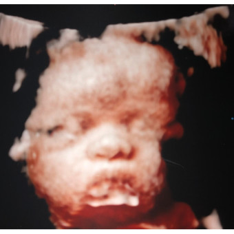 Babylist Registry Photo.
