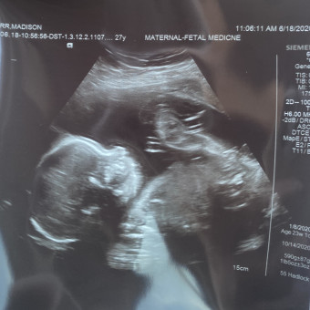 Babylist Registry Photo.
