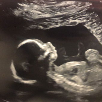 Babylist Registry Photo.