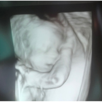 Babylist Registry Photo.