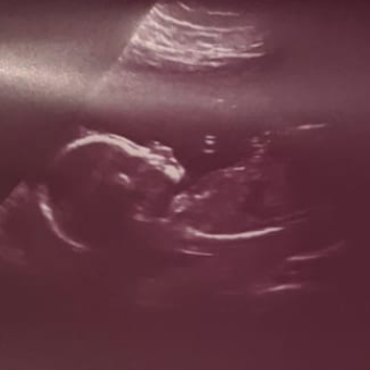 Babylist Registry Photo.
