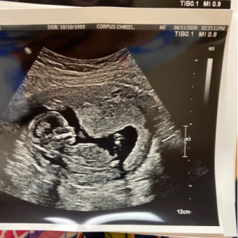 Babylist Registry Photo.
