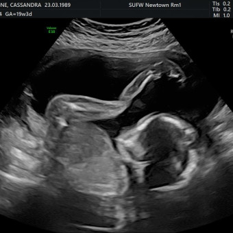 Babylist Registry Photo.