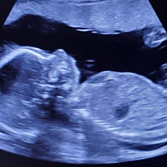 Babylist Registry Photo.