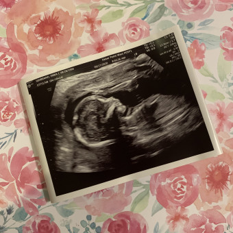 Babylist Registry Photo.