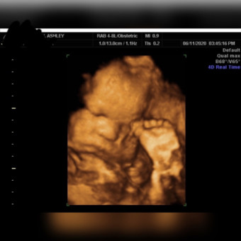 Babylist Registry Photo.