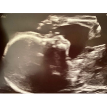 Babylist Registry Photo.