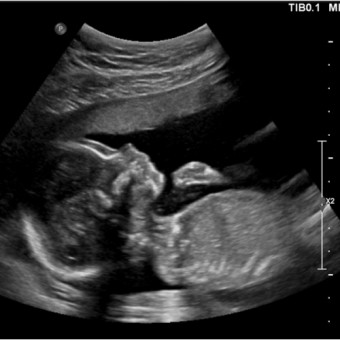 Babylist Registry Photo.