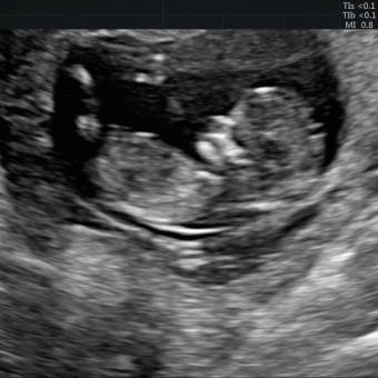 Babylist Registry Photo.
