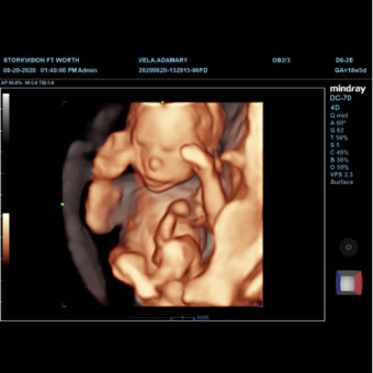 Babylist Registry Photo.