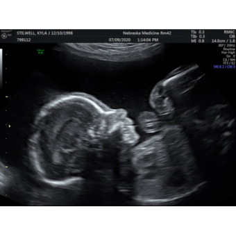 Babylist Registry Photo.