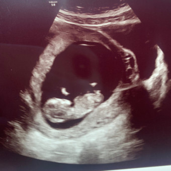 Babylist Registry Photo.